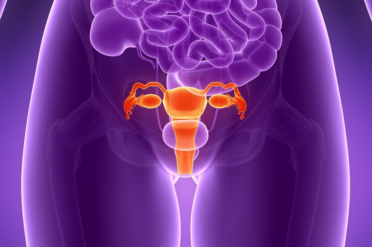 Problèmes de santé de la femme : ladénomyose utérine